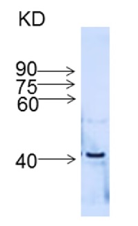IFR | isoflavone reductase in the group Antibodies Plant/Algal / Environmental Stress / Pathogen attack at Agrisera AB (Antibodies for research) (AS16 3847)